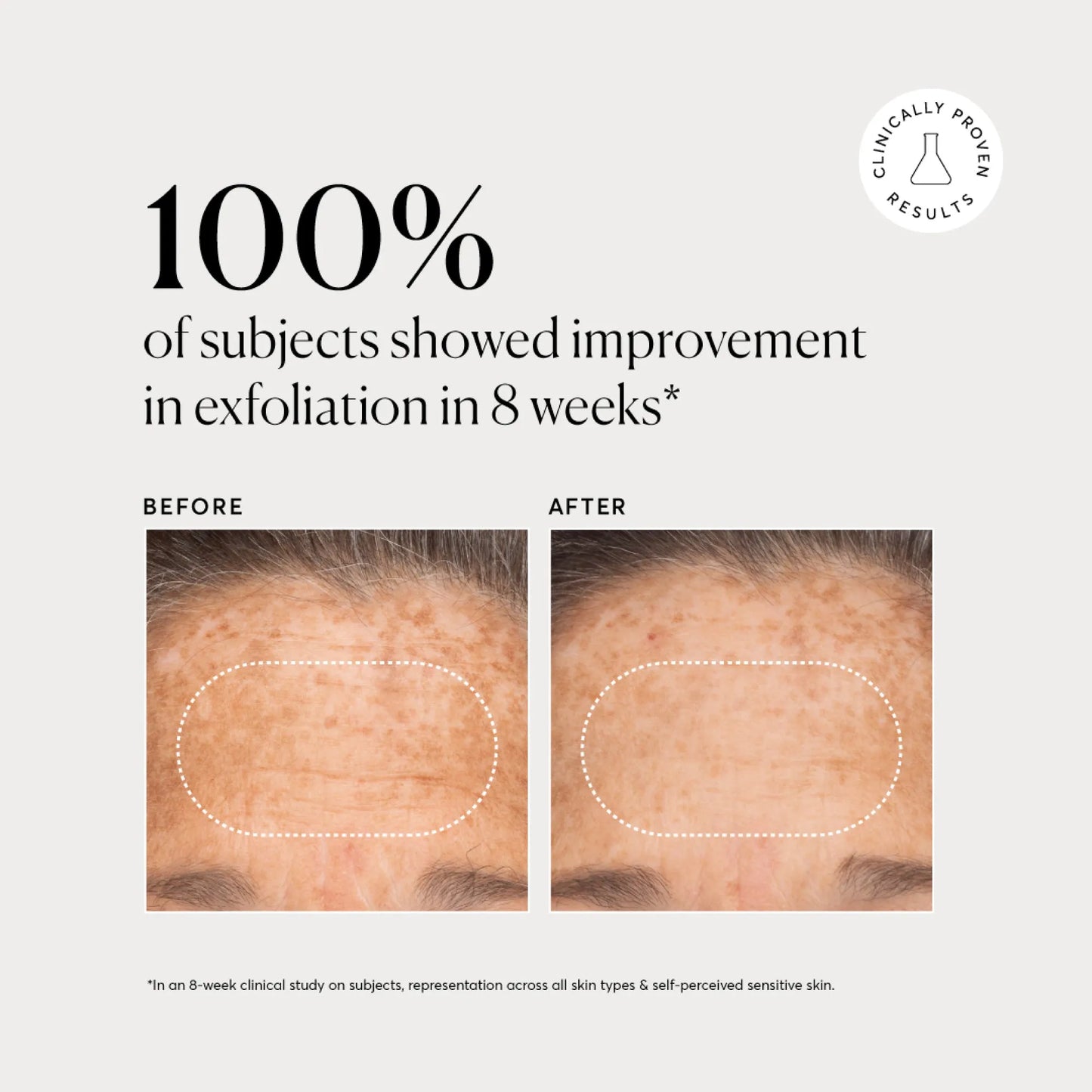 bha-liquid-exfoliant-2-p1 NATR-10027-Alt-Images-BHA-Liquid-Exfoliant-2_-03.webp